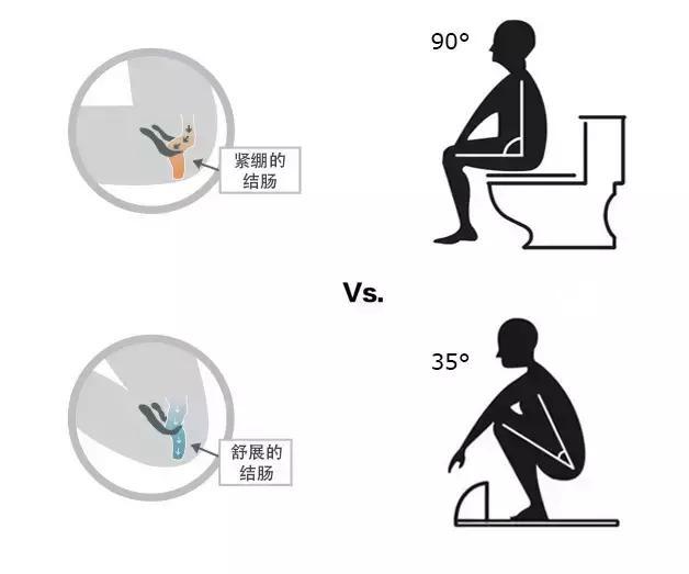 你平常是怎么上厕所的 脱裤子,直接坐在马桶上or蹲着?
