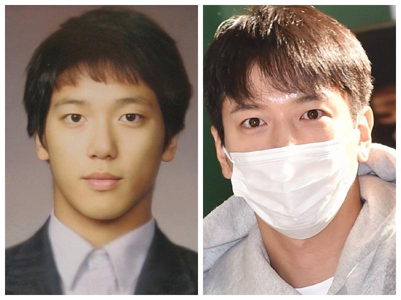 郑容和时单时双的眼皮