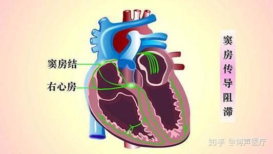 房室 zhuanlan.zhihu.com
