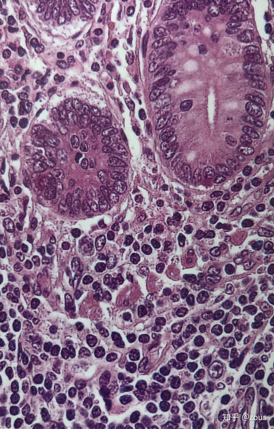 小肠隐窝细胞图片图片