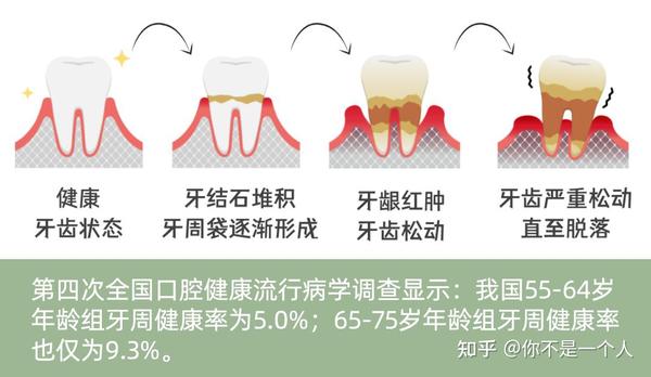 西安圣贝科普：“牙齿缺失”究竟是怎么来的？ - 知乎