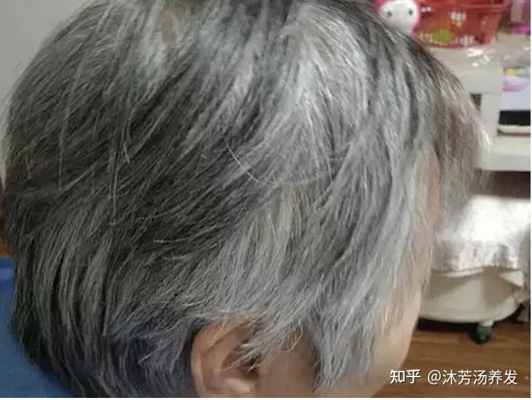 白发也分很多种,你是哪一种? - 知乎