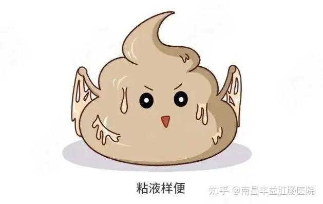 排便后请注意:有无白色鼻涕模样的伴随粪便一起排出!长期大便带大量黏液的朋友警惕!这可能是疾病信号! - 知乎