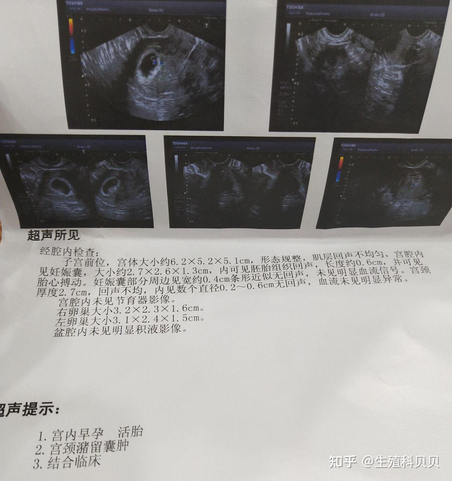 40岁卵巢早衰150斤移植一次成功怎么做到的