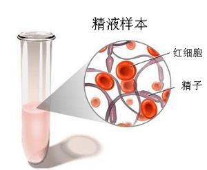 精液带血 先别方 知乎