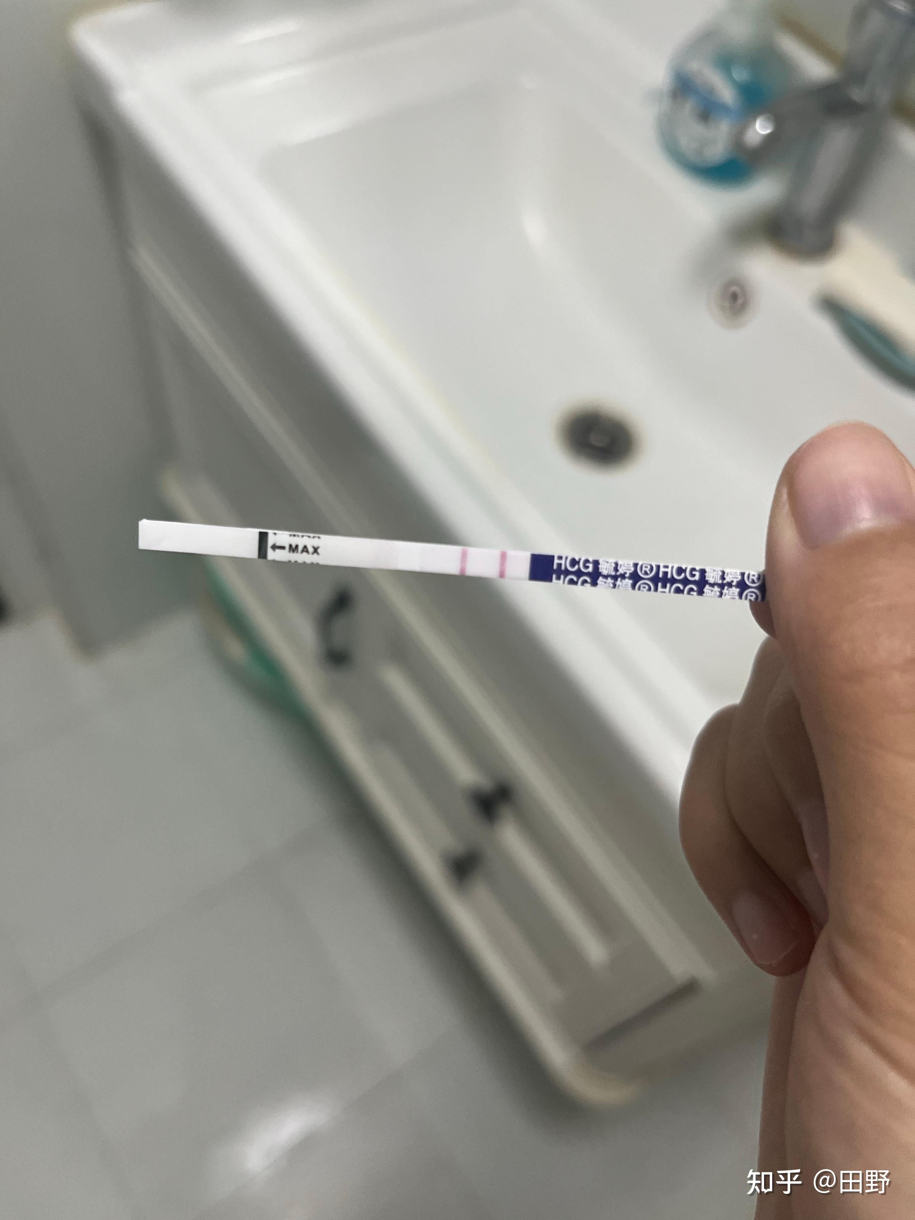 记录一下自己的孕期