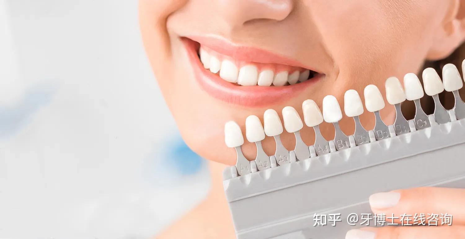 精瓷齿科 | 精瓷齿科技术（苏州）有限公司 | JC Dental - 精艳美学贴面