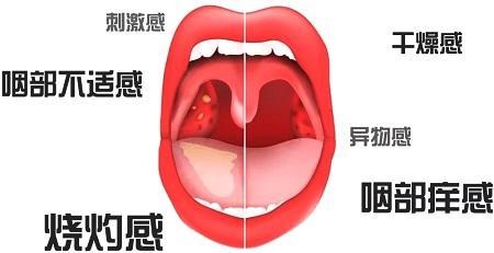 大人 肥大 扁桃 腺