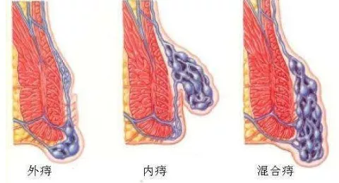 v2-cda651c53d4042c4c5c7176eb35d193f_r.jpg