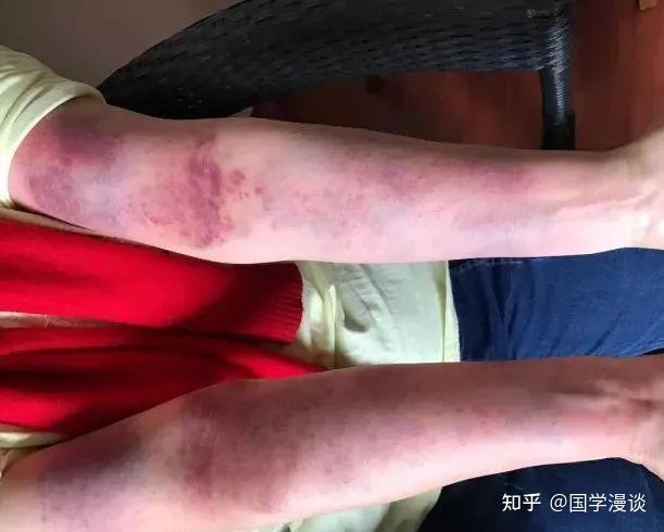 1,心包经:保护心脏.