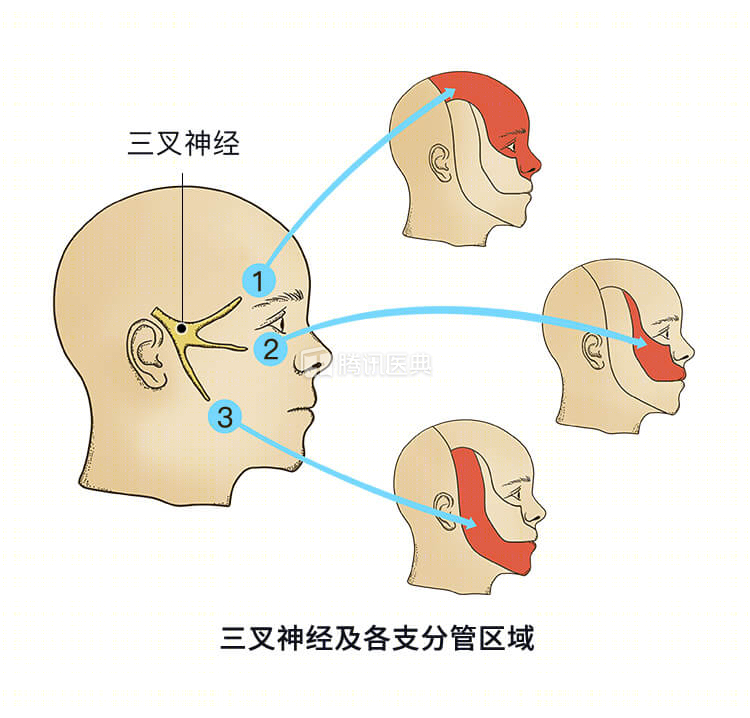 我仔细检查后发现,李叔右半边脸的疼痛位置,恰好是在三叉神经各条分支