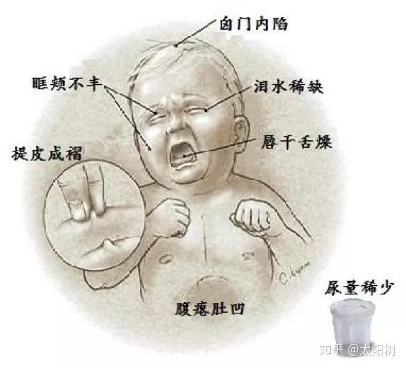 四.如何判断孩子是否脱水