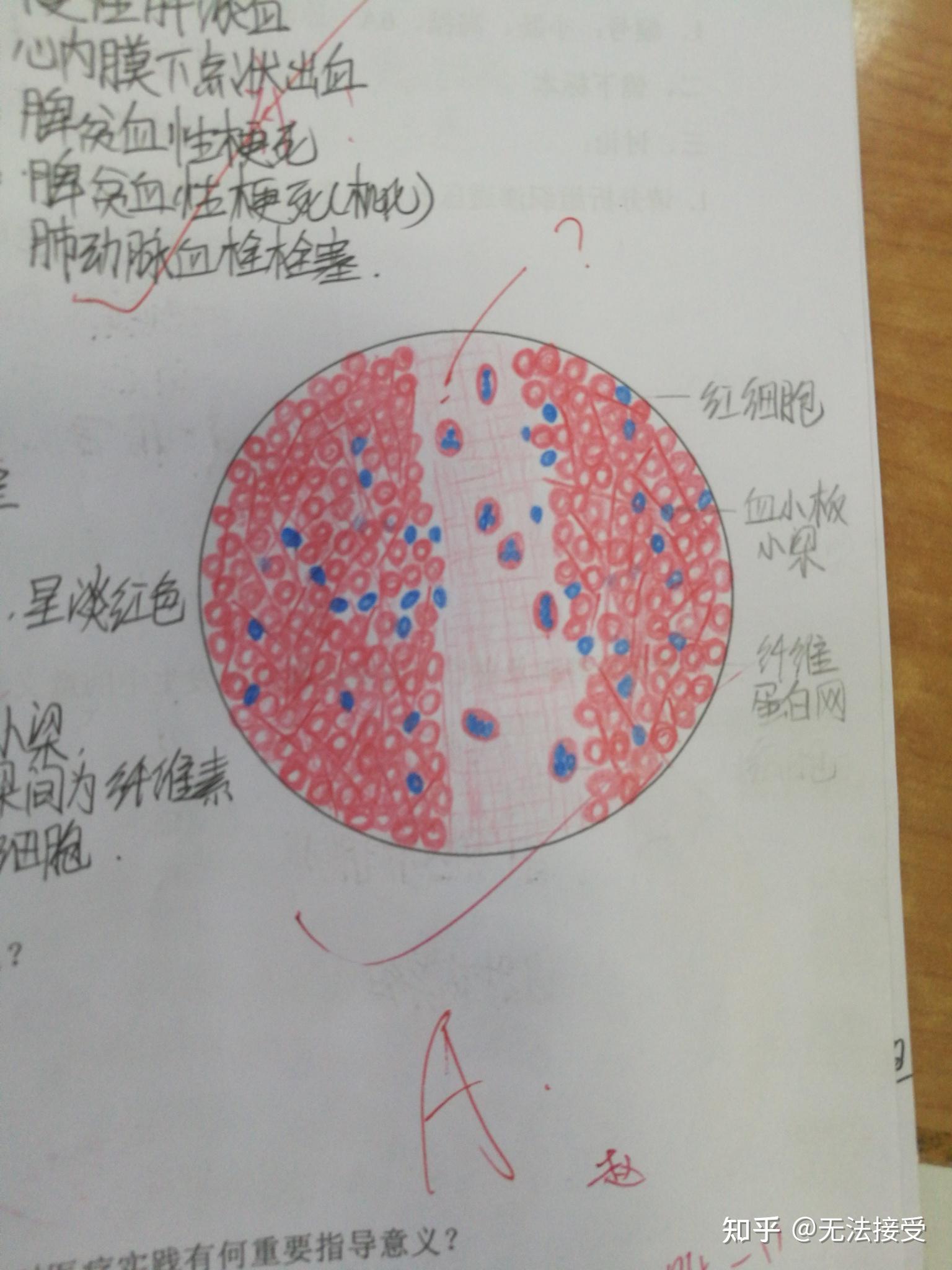 病理红蓝铅笔绘图