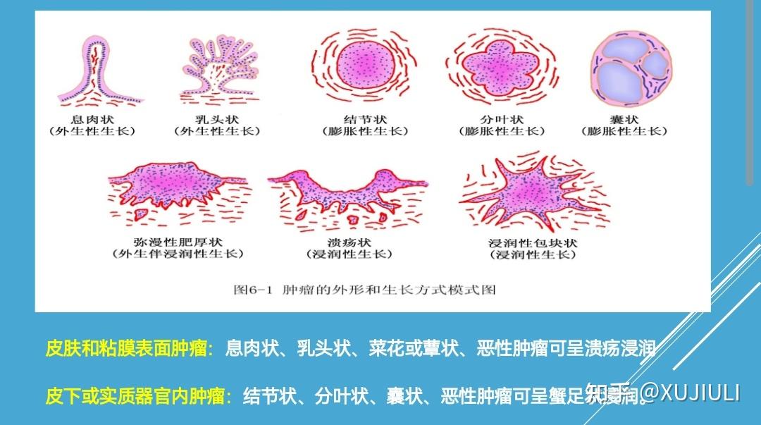 肿瘤学基础(笔记) - 知乎