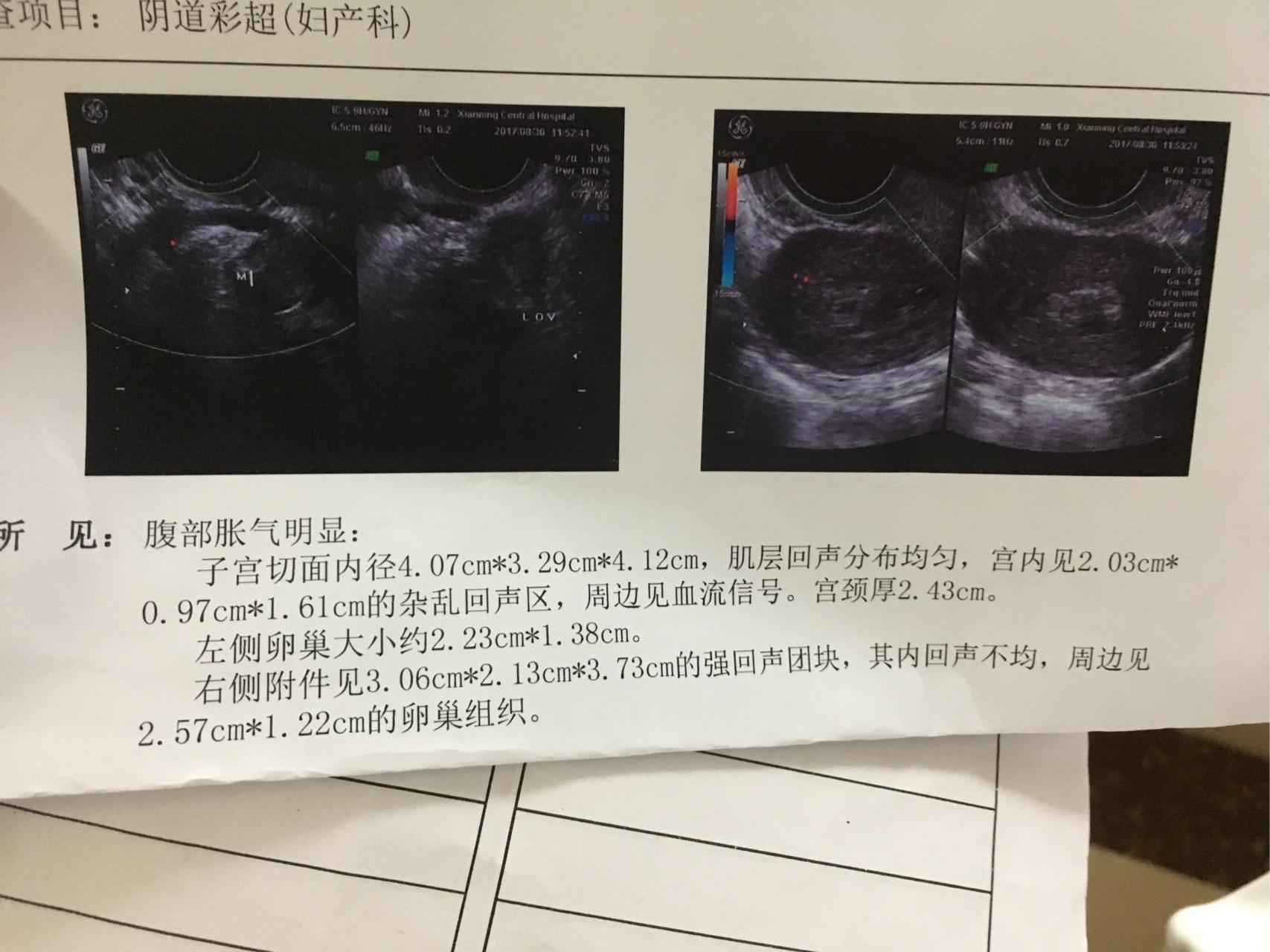 只要吃的東西都吐出來了 而且真的有氣無力的 d3 吃完米索之後一個半