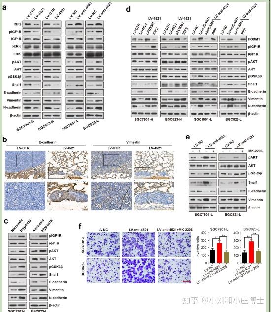 6-the expression levels of ets1, igf2, foxm1 and e-cadherin and