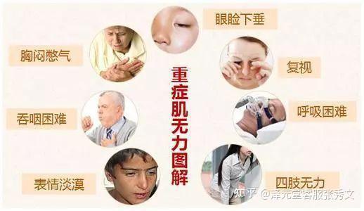 重症肌無力治不好的誤區