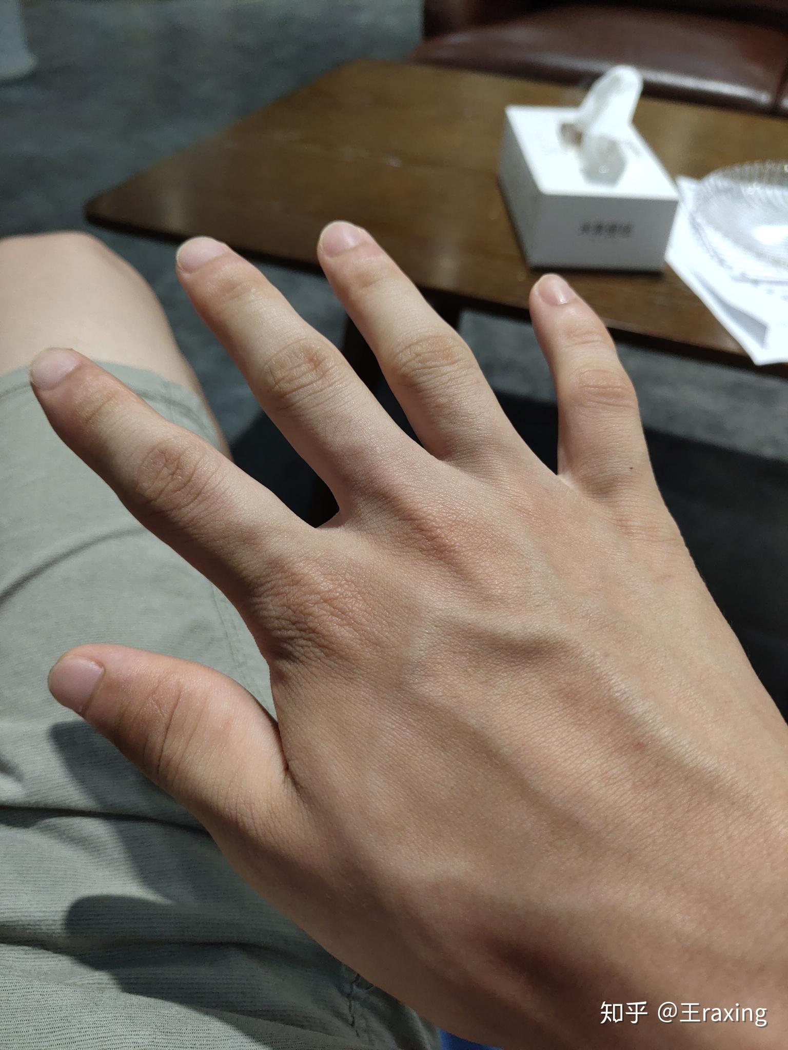 一只手有六个手指是种怎样的体验? - 知乎
