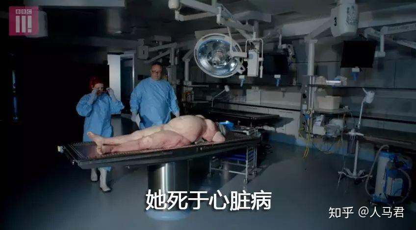 解剖死亡孕妇图片图片