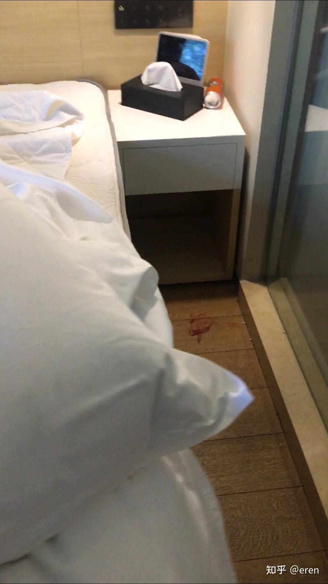 入住酒店磕破头缝六针请教总出血量约多少毫升