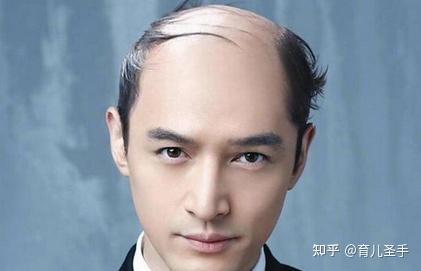 想剃光头戴假发,戴假发有什么坏处吗,买假发去哪买有推荐的吗? - 知乎