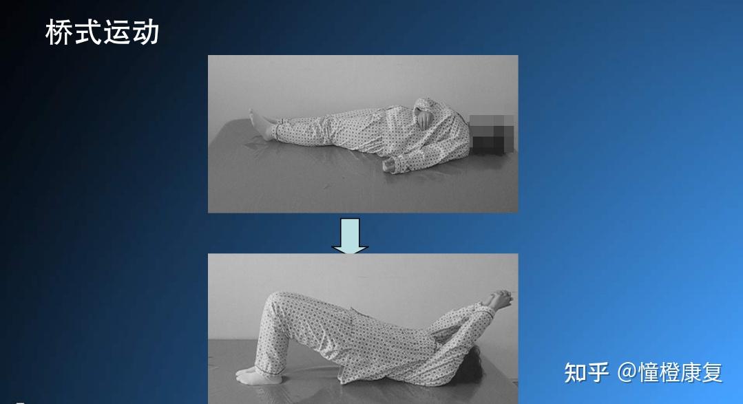 作业治疗之偏瘫患者床上活动 - 知乎