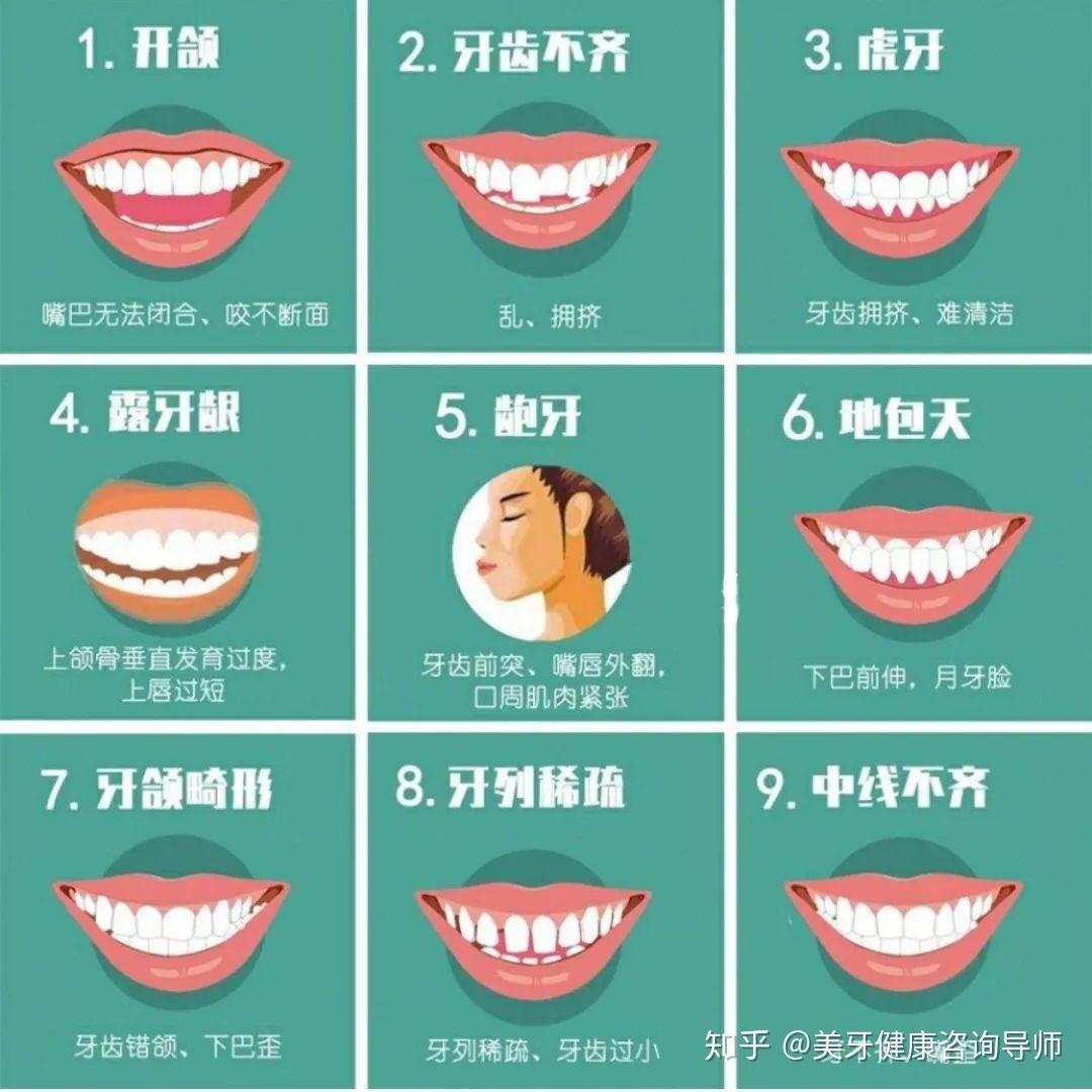 前牙开合矫正 - 知乎