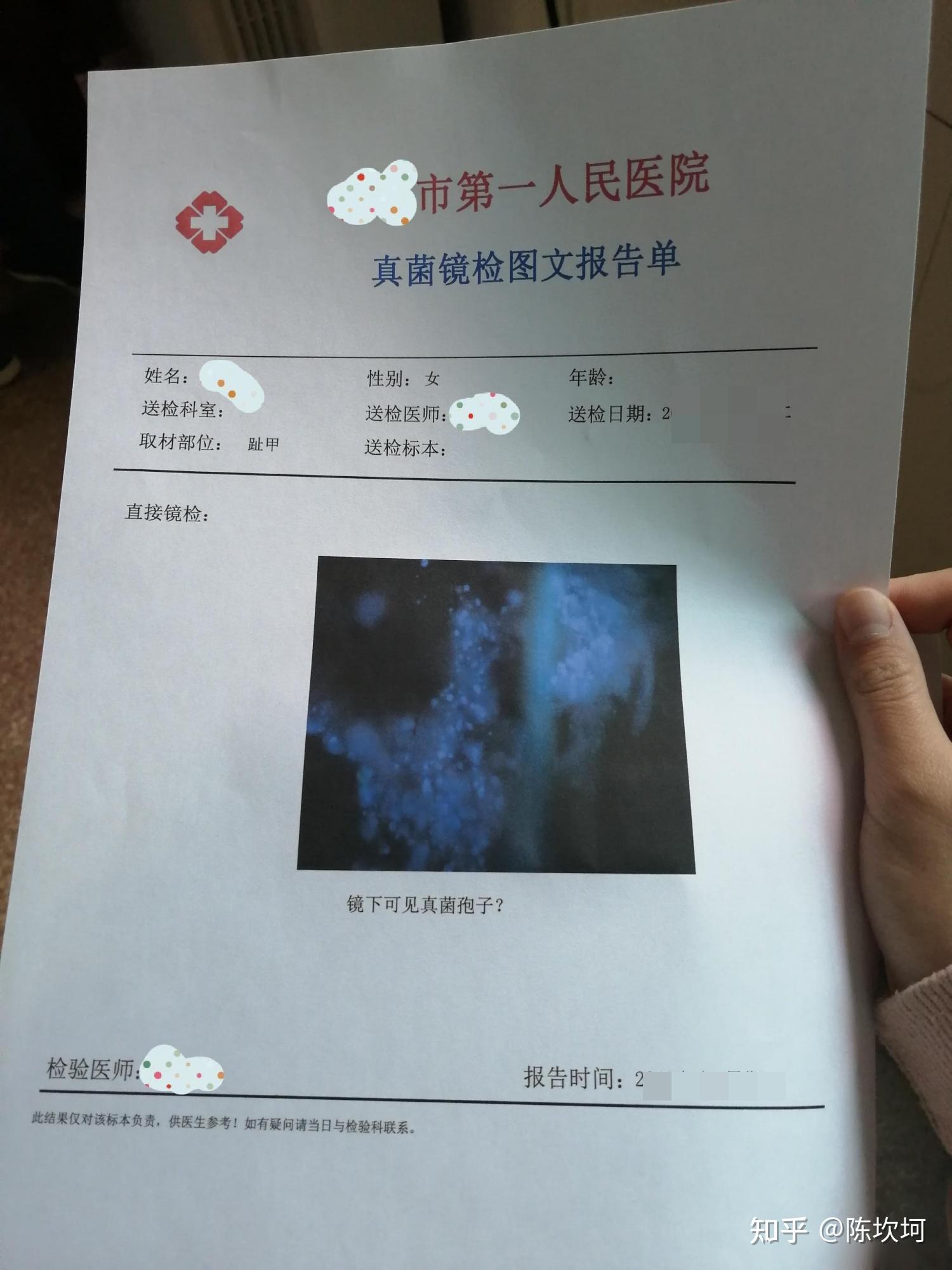 最后决定还是去医 院看,于是,挂号,做真菌检查,最终结果阳性,确定我是