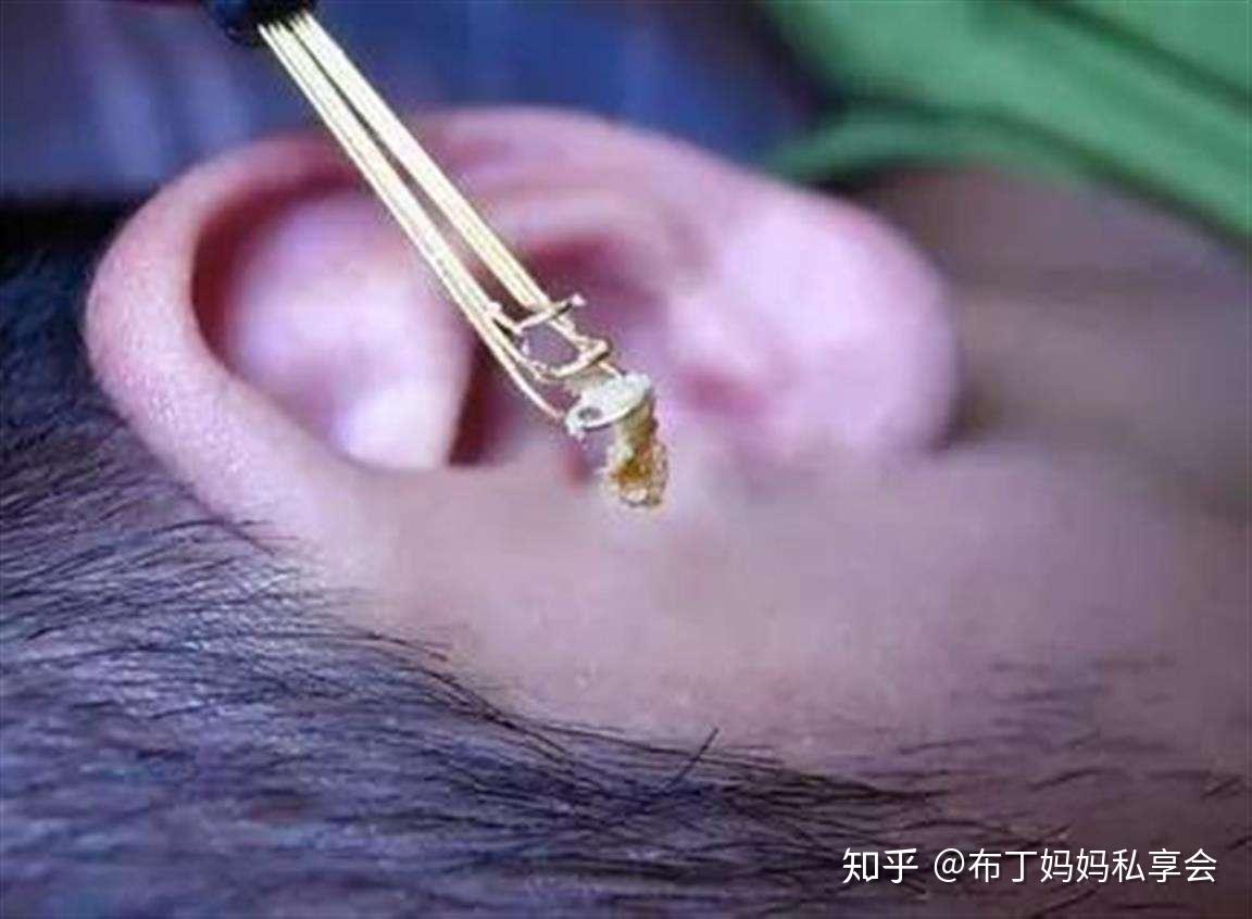 奶奶说吃耳屎变哑巴,孩子这样霸气反驳:跟吃鼻屎一样 - 知乎