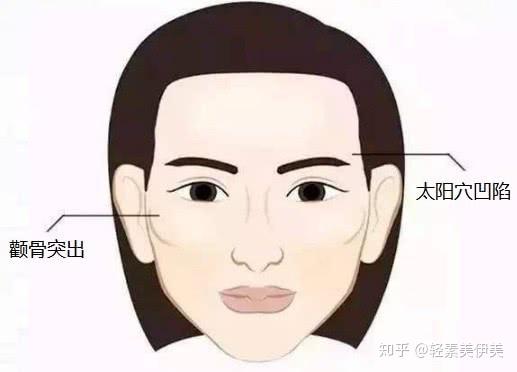 太阳穴凹陷或是颧骨突出,磨颧骨和填充太阳穴哪个更适合?