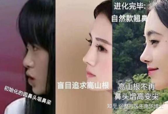 同样都是整容，有人成为模板，有人却被骂整容脸？ - 知乎