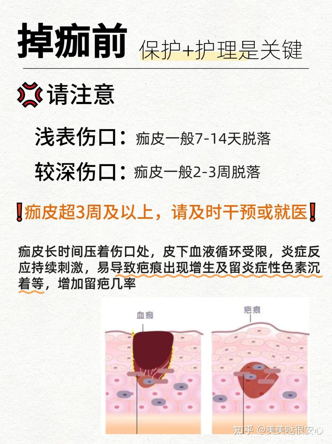 受伤不想留疤,掉痂前后正确处理讲清楚! - 知乎