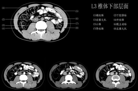 一图教你读懂 腹部CT - 知乎