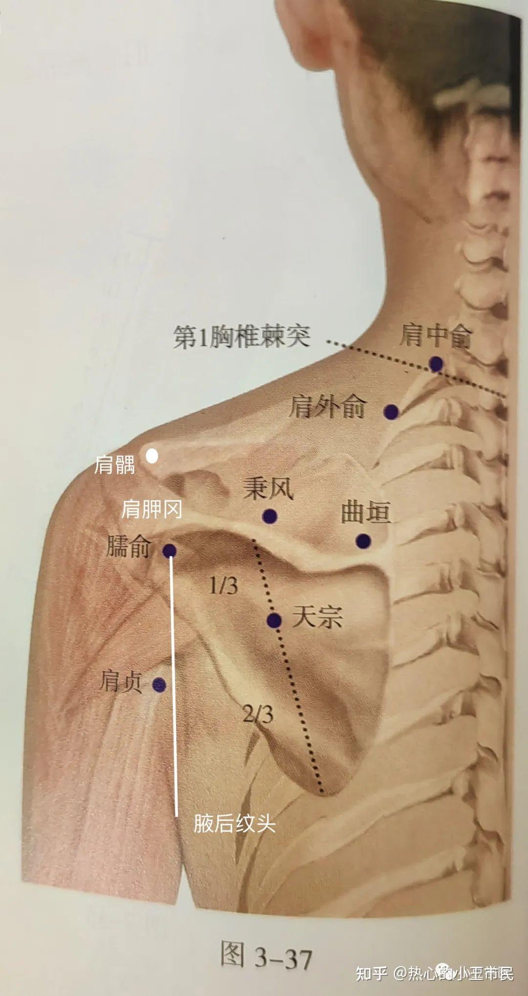 教科书的说法是 如上图肩胛冈中点与肩胛骨下角连线上1/3与下2/3交点