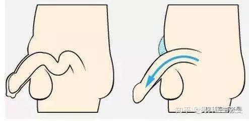 丁丁只有7cm正常吗成年后还能二次发育吗