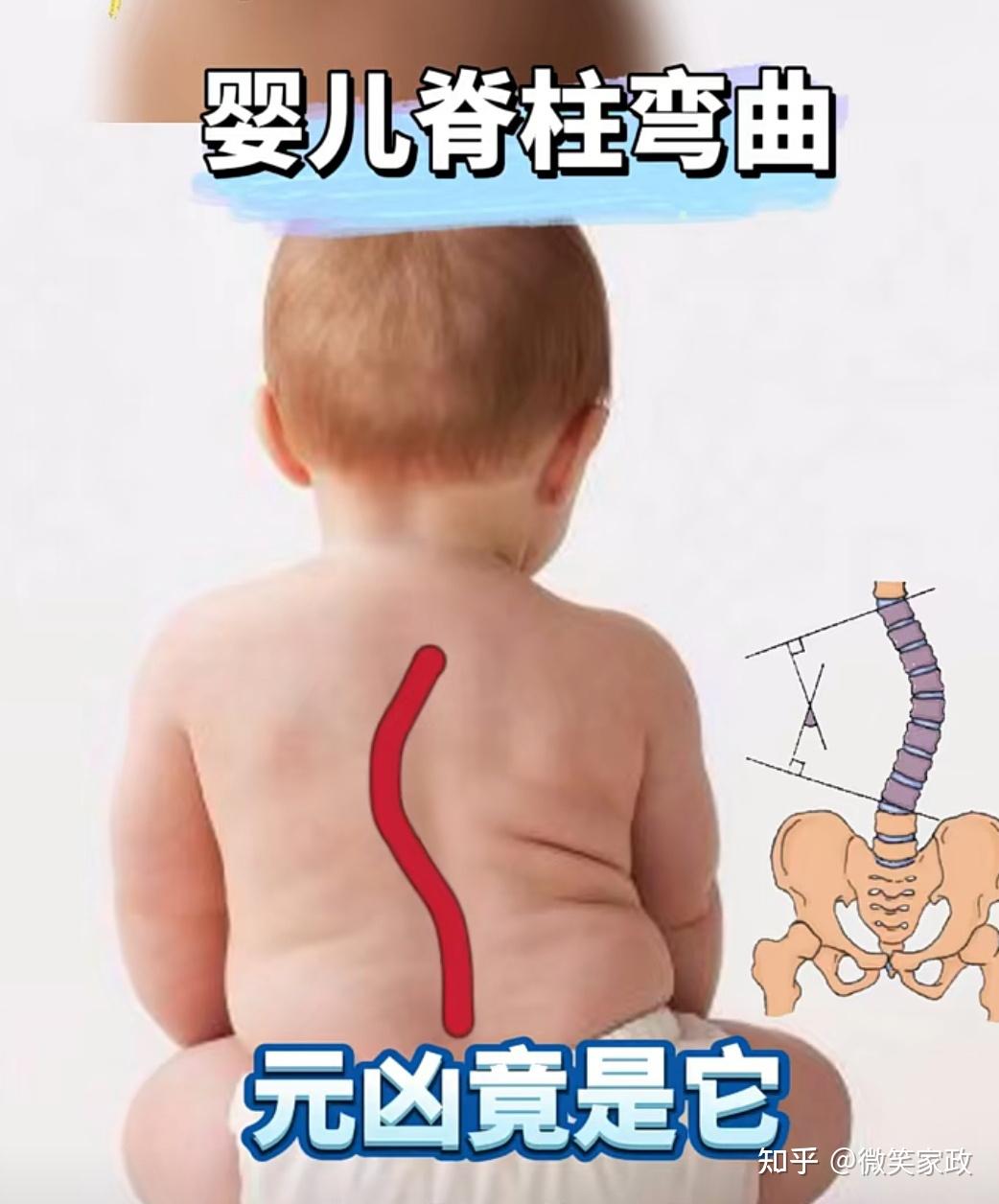 儿童脊柱健康海报PSD广告设计素材海报模板免费下载-享设计