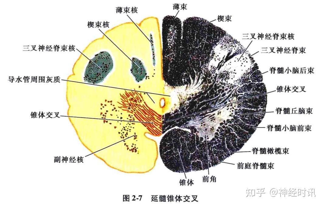脑干生理解剖病损定位人手一册