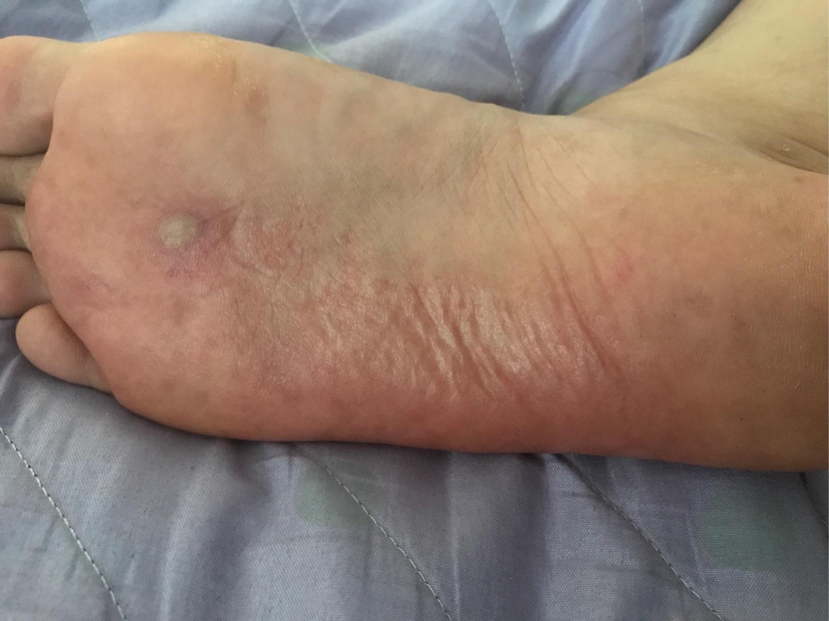 湿气可以危害到影响生活