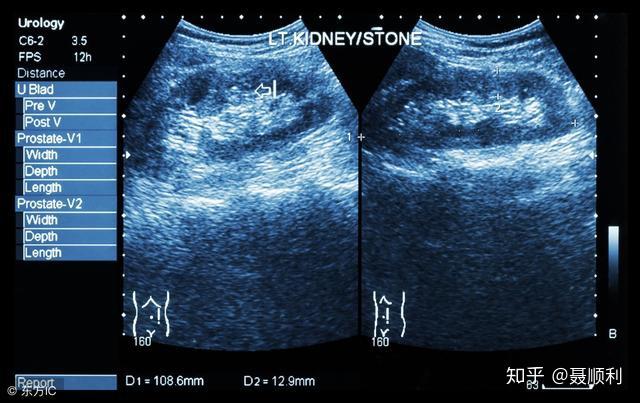v2-d124feb78cba317df15e2d7c98d91cdb_r.jpg