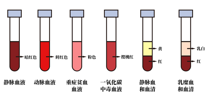 血液为什么是红色的 蓝色的 绿色的 白色的 知乎