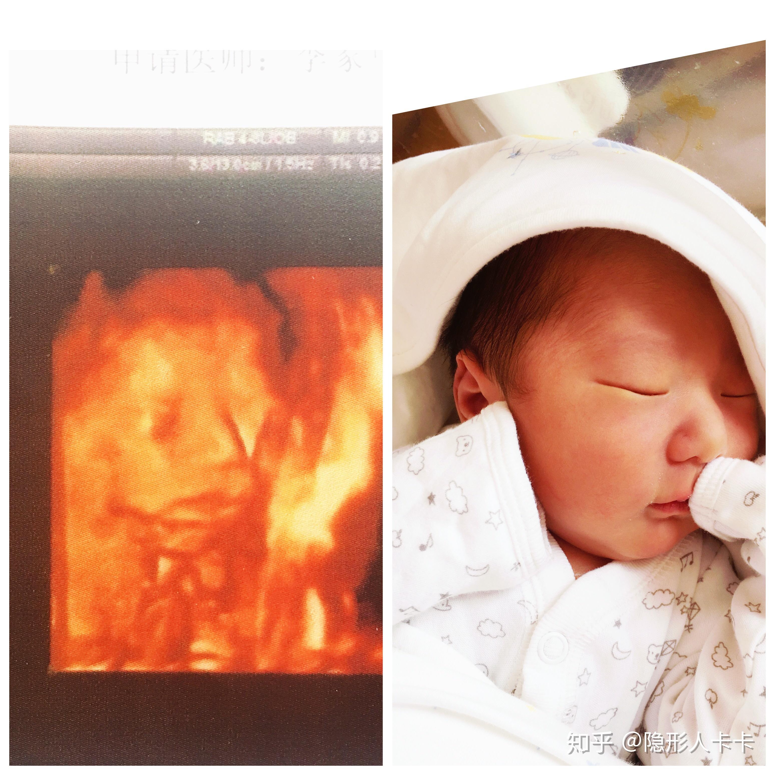 如何才能怀孕生孩子 v2-d178f08fcfdcd1d389b22607cdcaa6fb_r.jpg