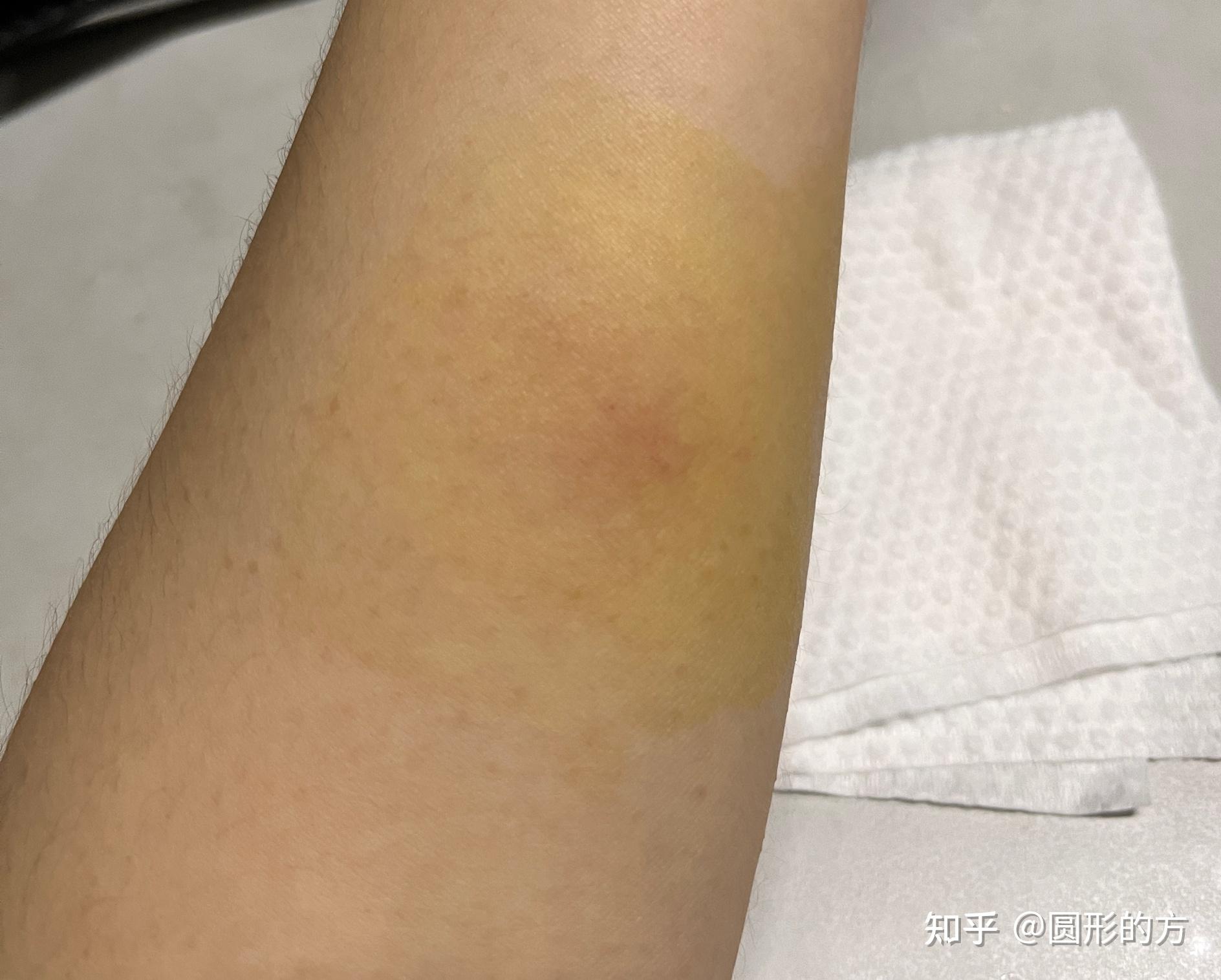 ppd72小时77心路历程持续记录95 - 知乎