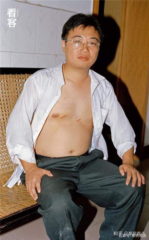 2004年,当时的东江镇计生办主任谭志勇下乡时,被计生对象砍了.