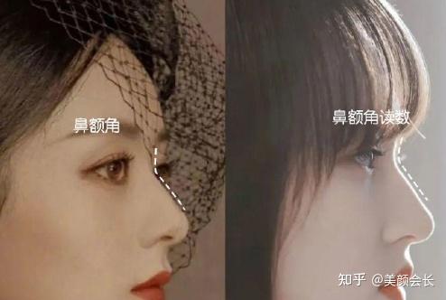 73山根起点:不要太高,要带点柔和的鼻额角转折感,额头山根连在一起