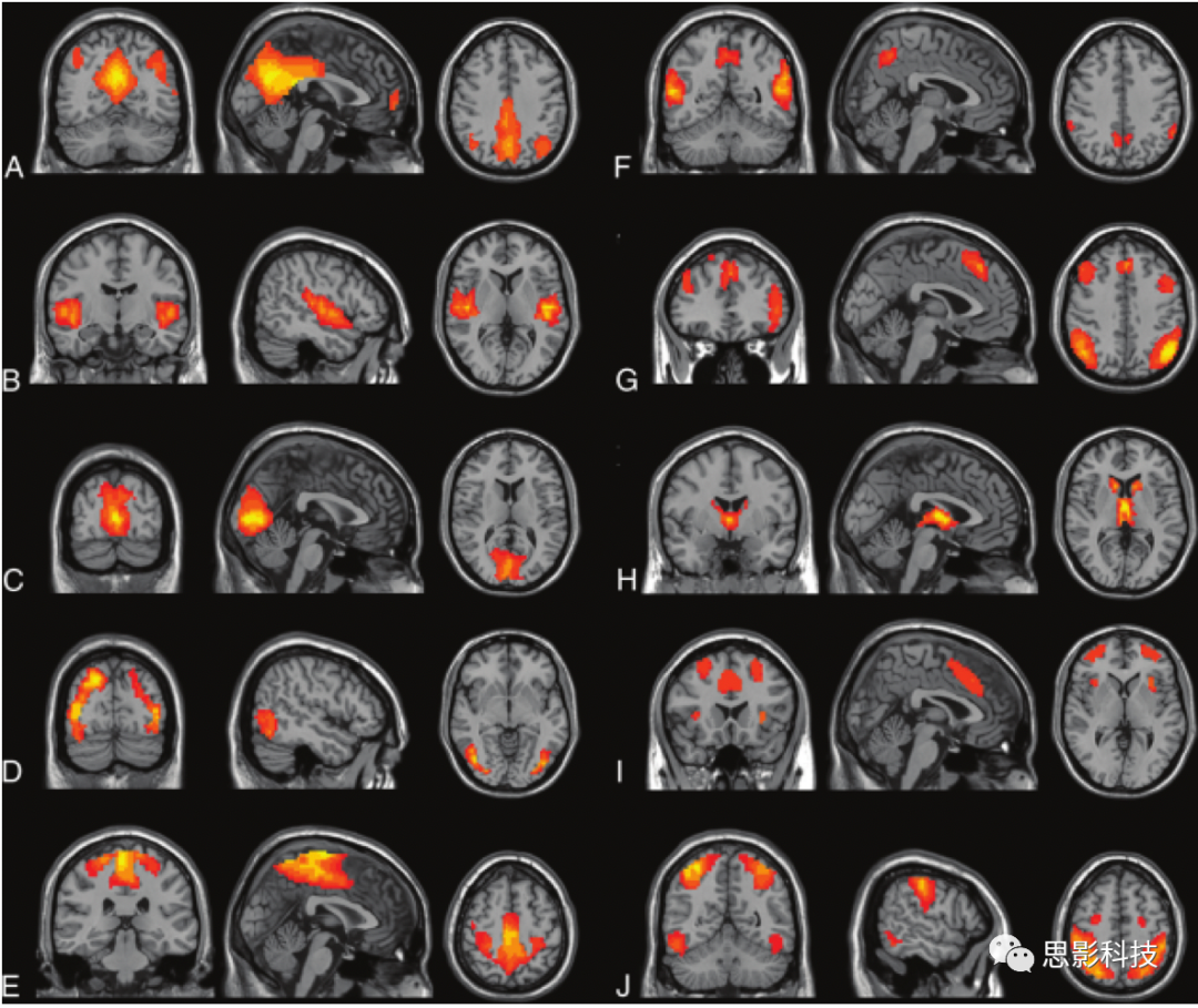 迄今最完整最高清人脑的7T磁共振成像，比临床头部图像详细1000倍_凤凰网视频_凤凰网