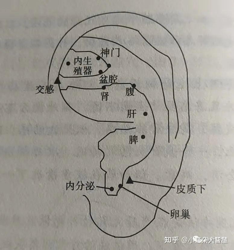 【治疗】取耳穴:内生殖器,腹,盆腔,肾,肝,交感,皮质下,神门,卵巢,内