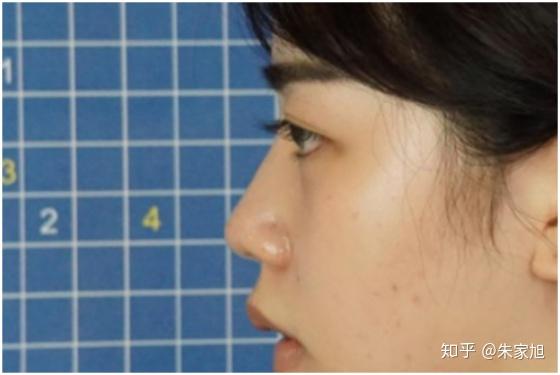 如何拥有好看鼻子 v2-d2210c80fddf1befeca08200bc2f036b_r.jpg