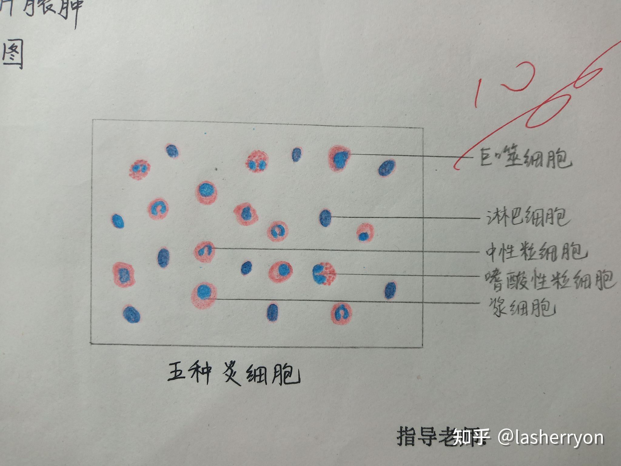 浆细胞的红蓝铅笔图图片