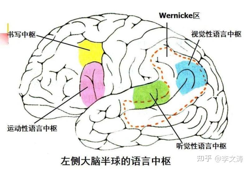 突发好莱坞巨星因患失语症宣布息影这到底是什么病会康复么