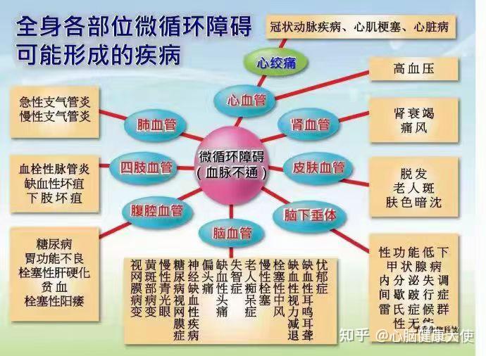 微血流紊乱示意图解析图片